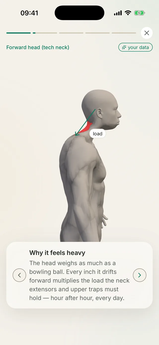 Kallen app screen: a posture story played on the 3D model, explaining the pattern